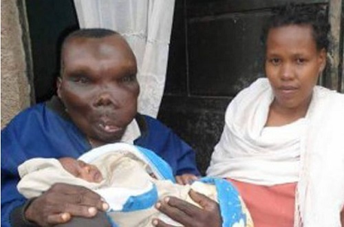 Ugliest Man In Uganda Becomes Dad For The Eighth Time | DFX MEDIA